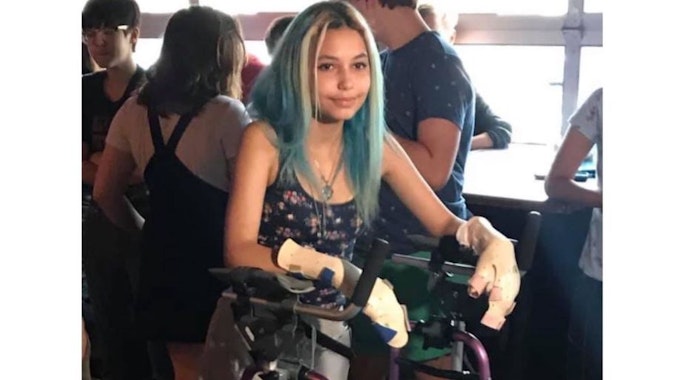 Die US-Amerikanerin Paige Winter läuft mit einer Gehhilfe, ihre Hände sind bandagiert, sie trägt eine Beinprothese, aber sie lächelt.
