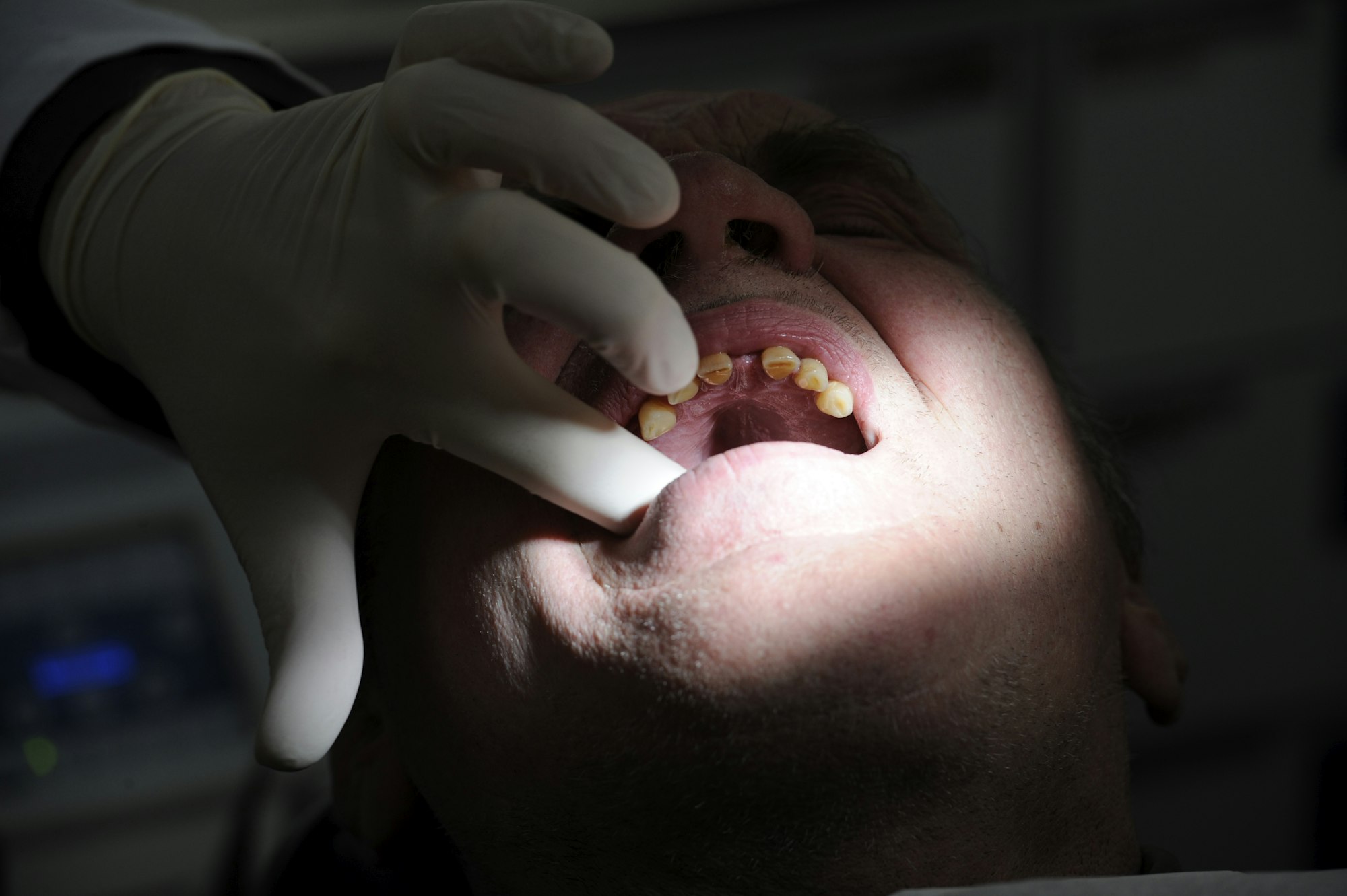 Ein Zahnarzt aus Hamburg behandelt im Februar 2010 einen Patienten im Zahnmobil vor der Bahnhofsmission.