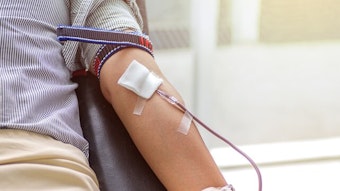Ein Blutspender hat eine Kanüle im Arm, über die Blut entnommen wird (Symbolfoto).