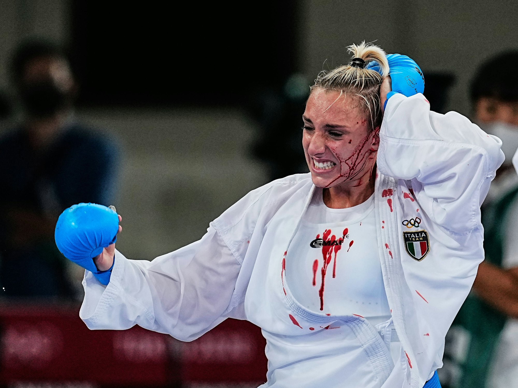 Die italienische Karateka Silvia Semeraro hält sich ihren blutenden Kopf.