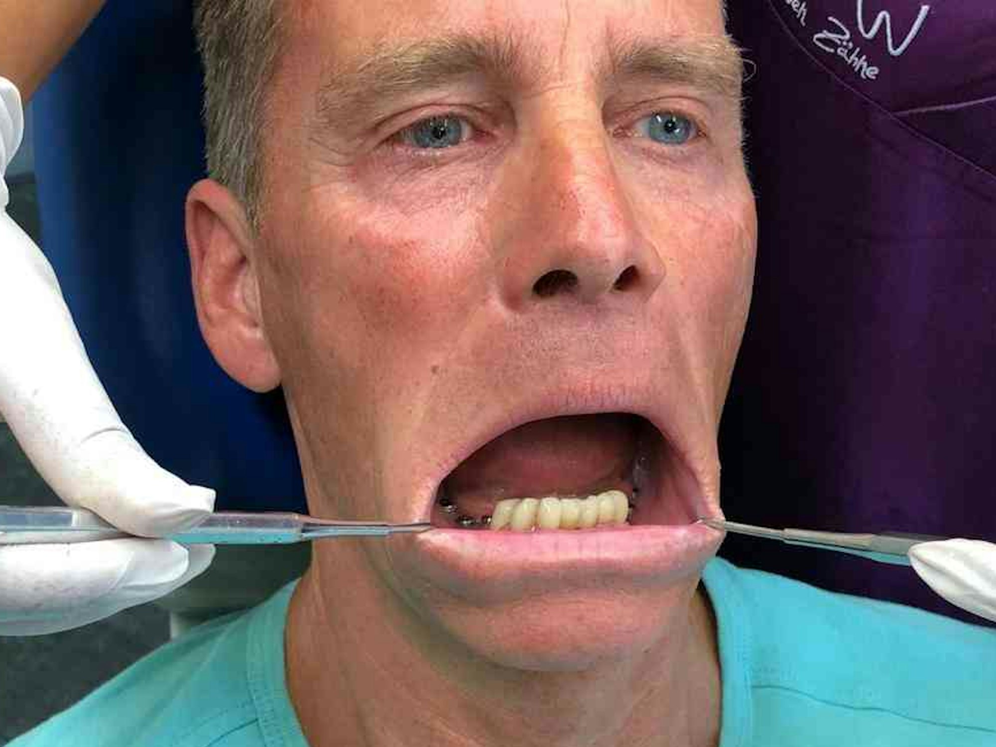 BB-Star Jürgen Milski wird in einer Zahnarztpraxis behandelt.