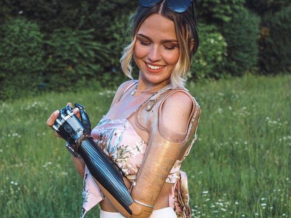 Die Wuppertalerin Gina Rühl posiert mit einer Arm-Prothese.