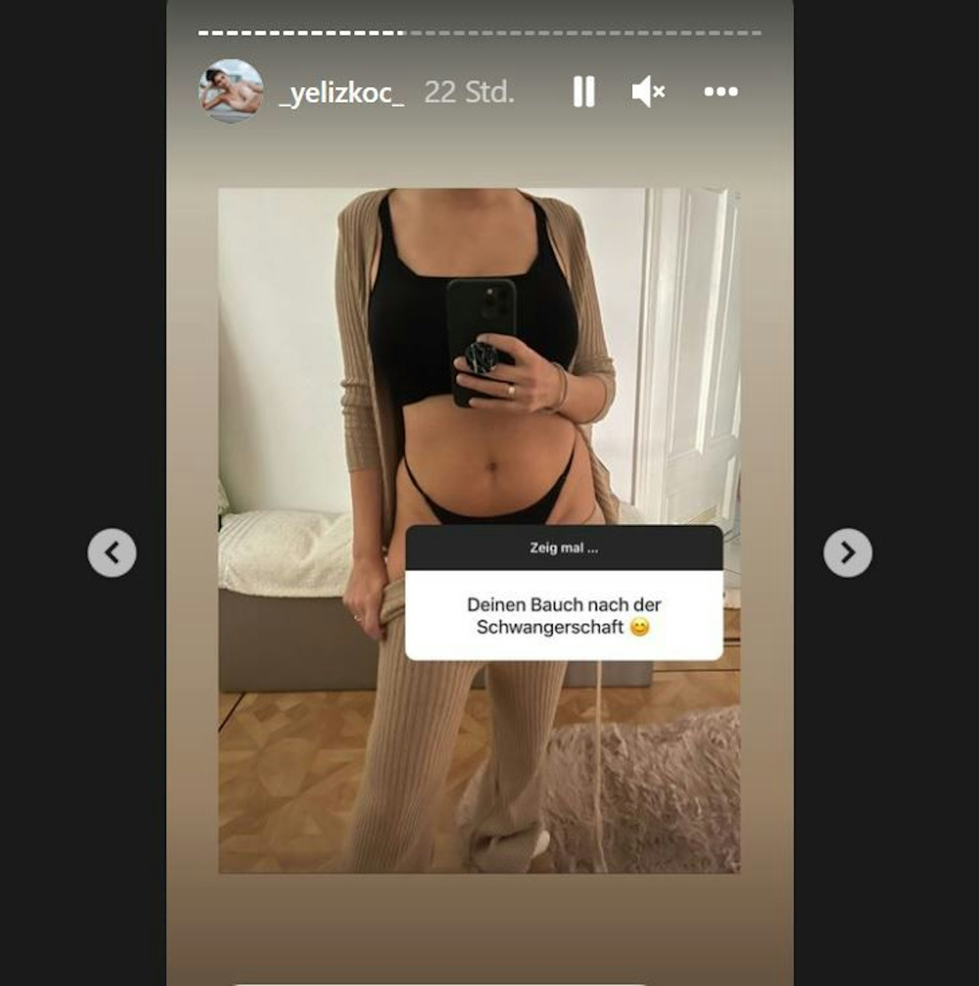 Yeliz Koc zeigt ein Foto von ihrem Bauch nach der Schwangerschaft.