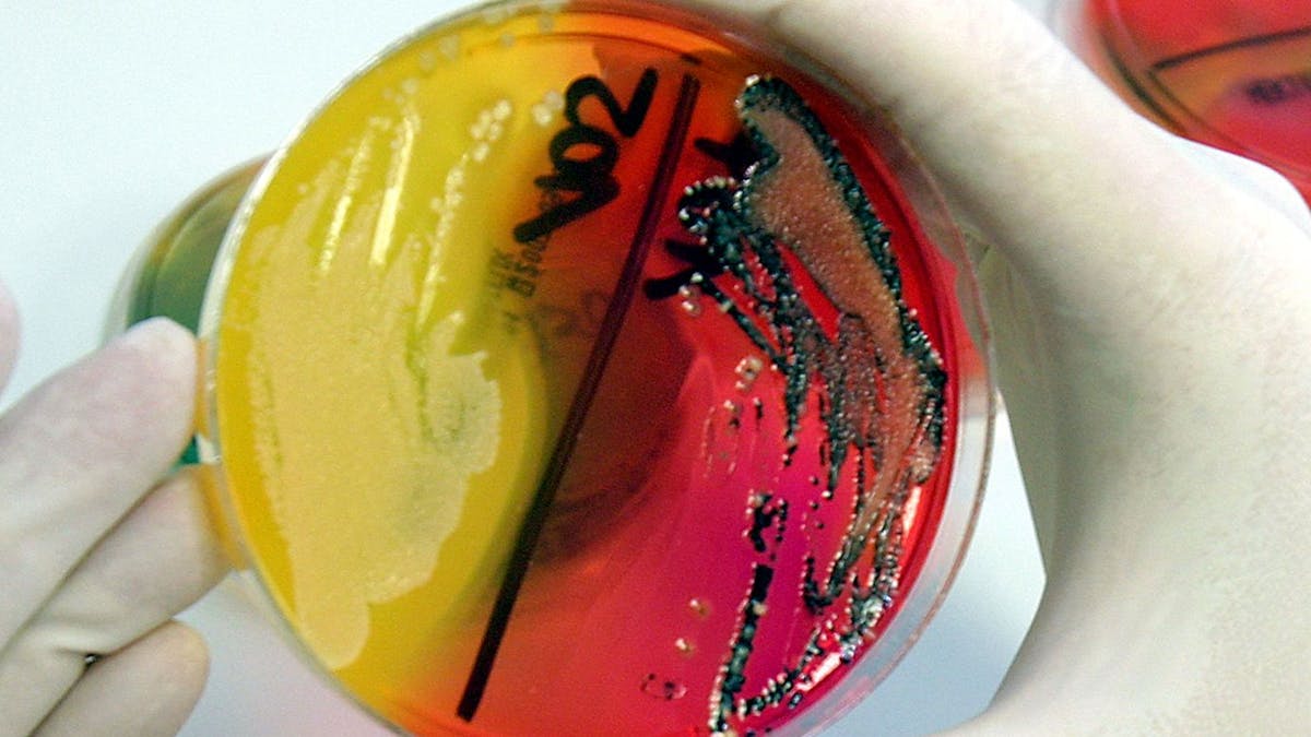 22.05.2007 in Fulda: Eine Labor-Mitarbeiterin zeigt eine Petrischale mit einer Salmonellenkultur.