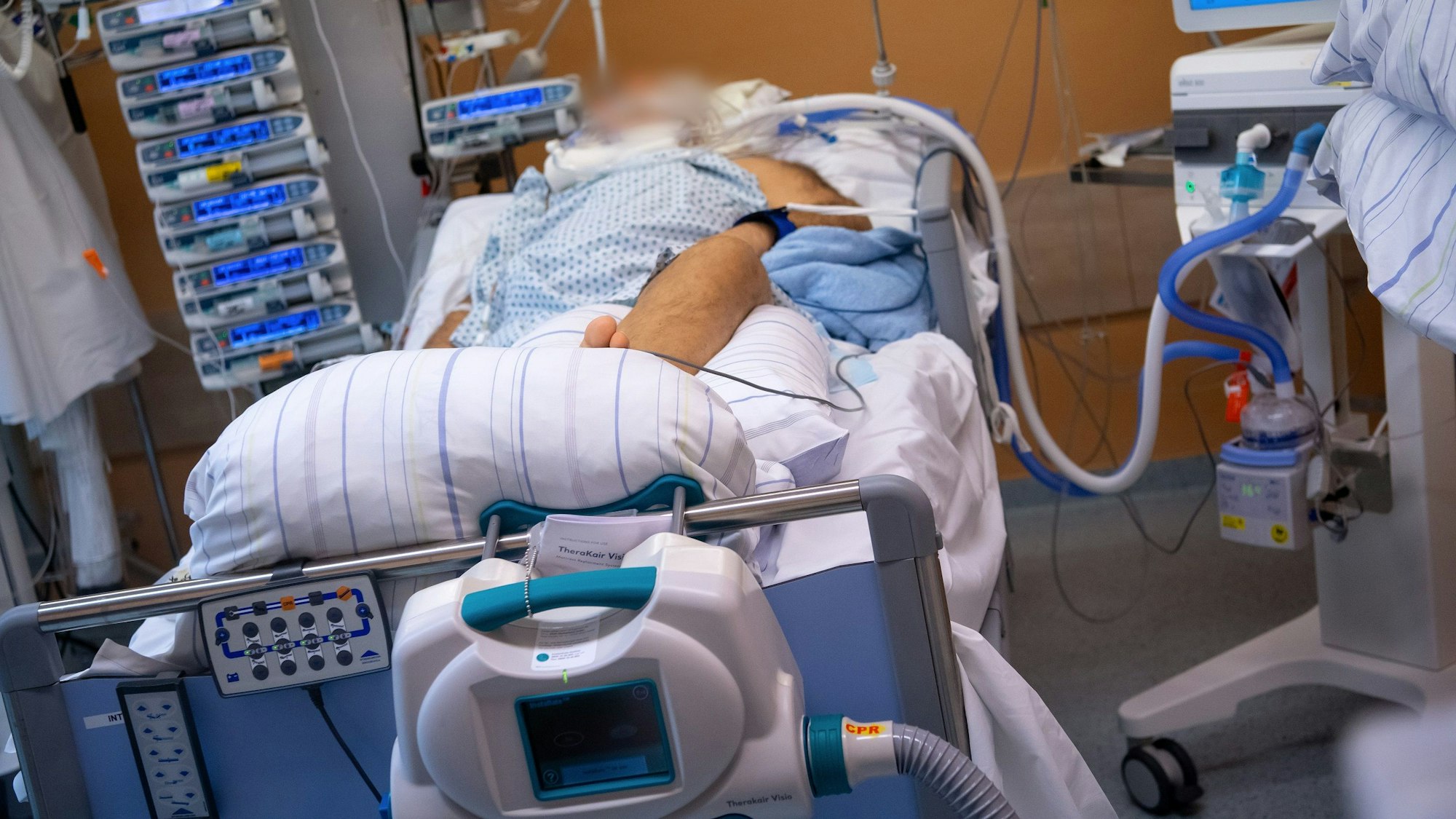 Ein Covid-19 Patient liegt in einem isoliertem Intensivbett-Zimmer in der Asklepios Klinik. Der Patient liegt im künstlichen Koma und wird beatmet.