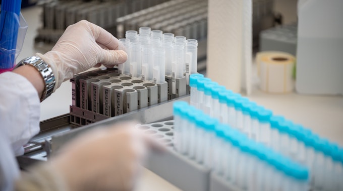Eine Labormitarbeiterin bereitet im Labor in Mittelhessen Teströhrchen für einen PCR-Test vor. Die WHO warnt vor der Entstehung noch gefährlicherer Virusvarianten.