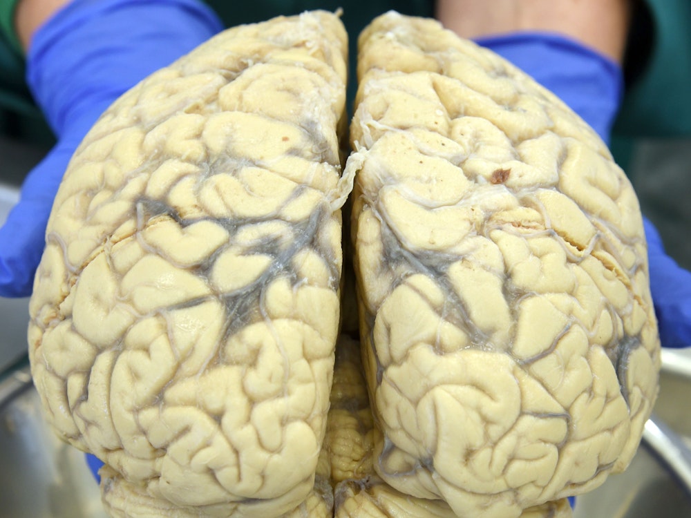 Im Präpariersaal der Medizinischen Fakultät an der Martin-Luther-Universität hält die Direktorin des Institutes das Gehirn eines Körperspenders in den Händen.