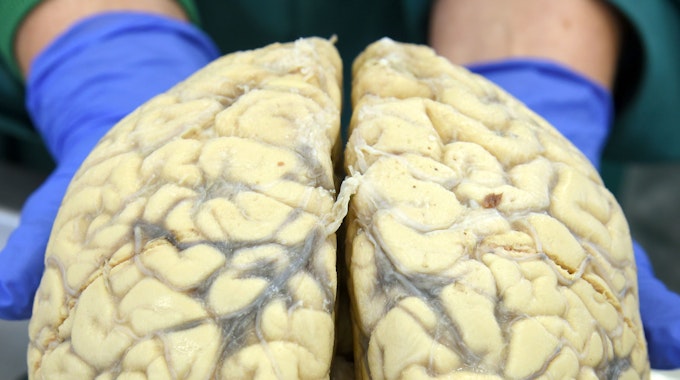 Im Präpariersaal der Medizinischen Fakultät an der Martin-Luther-Universität hält die Direktorin des Institutes das Gehirn eines Körperspenders in den Händen.