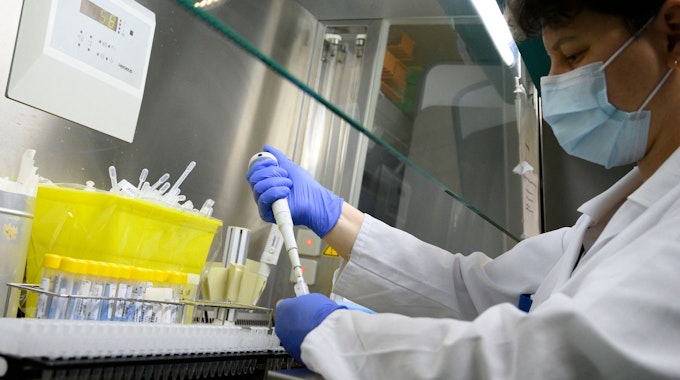 Eine Labormitarbeiterin im Robert Bosch Krankenhaus in Stuttgart bereitet am 2. Februar 2022 einen PCR-Test vor.