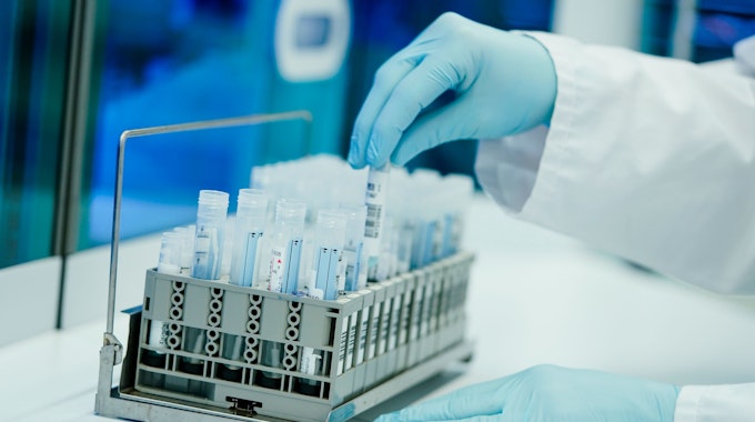 Ein Mitarbeiter hält in einem Coronatest-Labor PCR-Teströhrchen in den Händen.