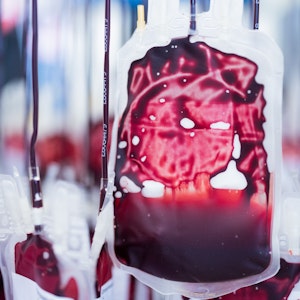 Mikroplastik wurde nun erstmals im menschlichen Blut (hier ein Symbolfoto) nachgewiesen.
