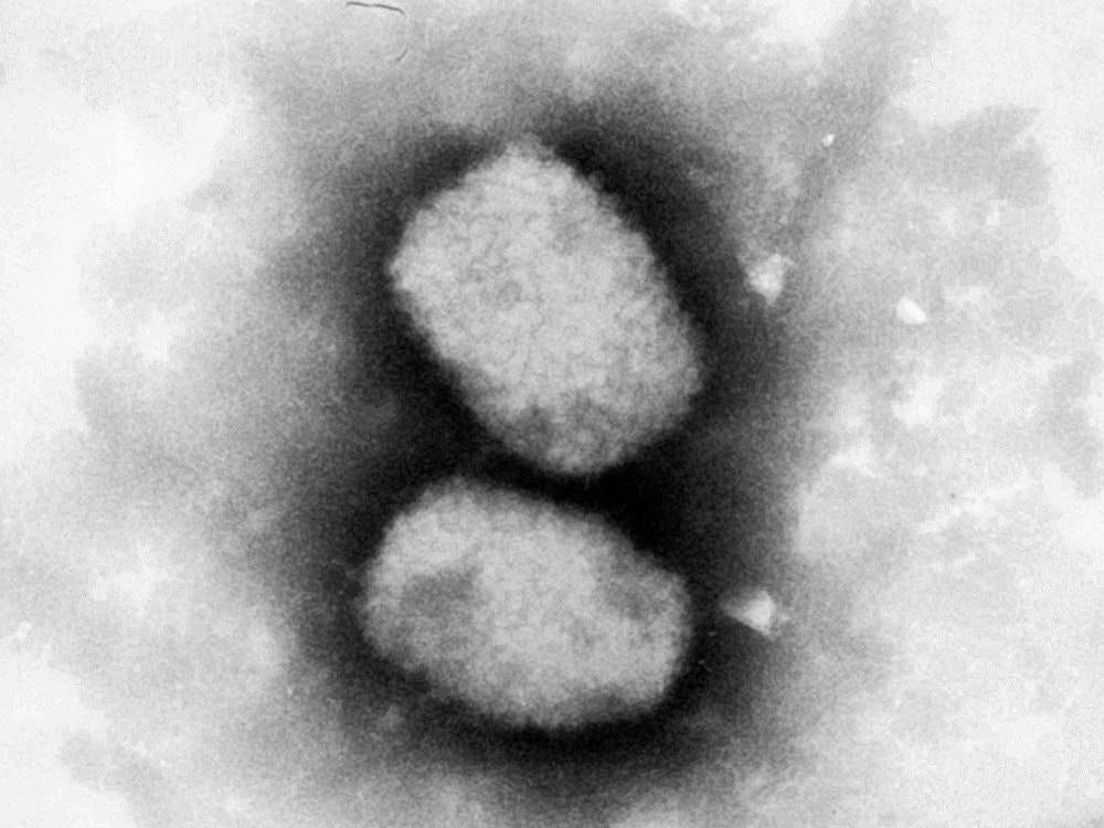 Diese vom Robert Koch-Institut (RKI) zur Verfügung gestellte elektronenmikroskopische Aufnahme zeigt das Affenpockenvirus. Nach mehreren Fällen von Affenpocken bei Menschen in Großbritannien sensibilisiert das Robert Koch-Institut (RKI) in Deutschland für die Virusinfektion.