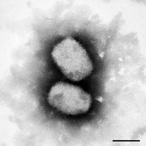 Diese vom Robert Koch-Institut (RKI) zur Verfügung gestellte elektronenmikroskopische Aufnahme zeigt das Affenpockenvirus. Nach mehreren Fällen von Affenpocken bei Menschen in Großbritannien sensibilisiert das Robert Koch-Institut (RKI) in Deutschland für die Virusinfektion.