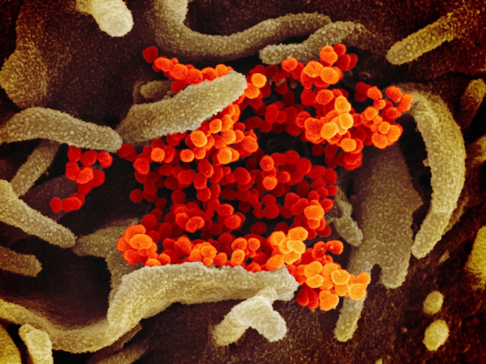 Eine undatierte elektronenmikroskopische Aufnahme des «U.S. National Institute of Health» zeigt das neuartige Coronavirus (SARS-CoV-2) (orange), das aus der Oberfläche von im Labor kultivierten Zellen (grau) austritt.