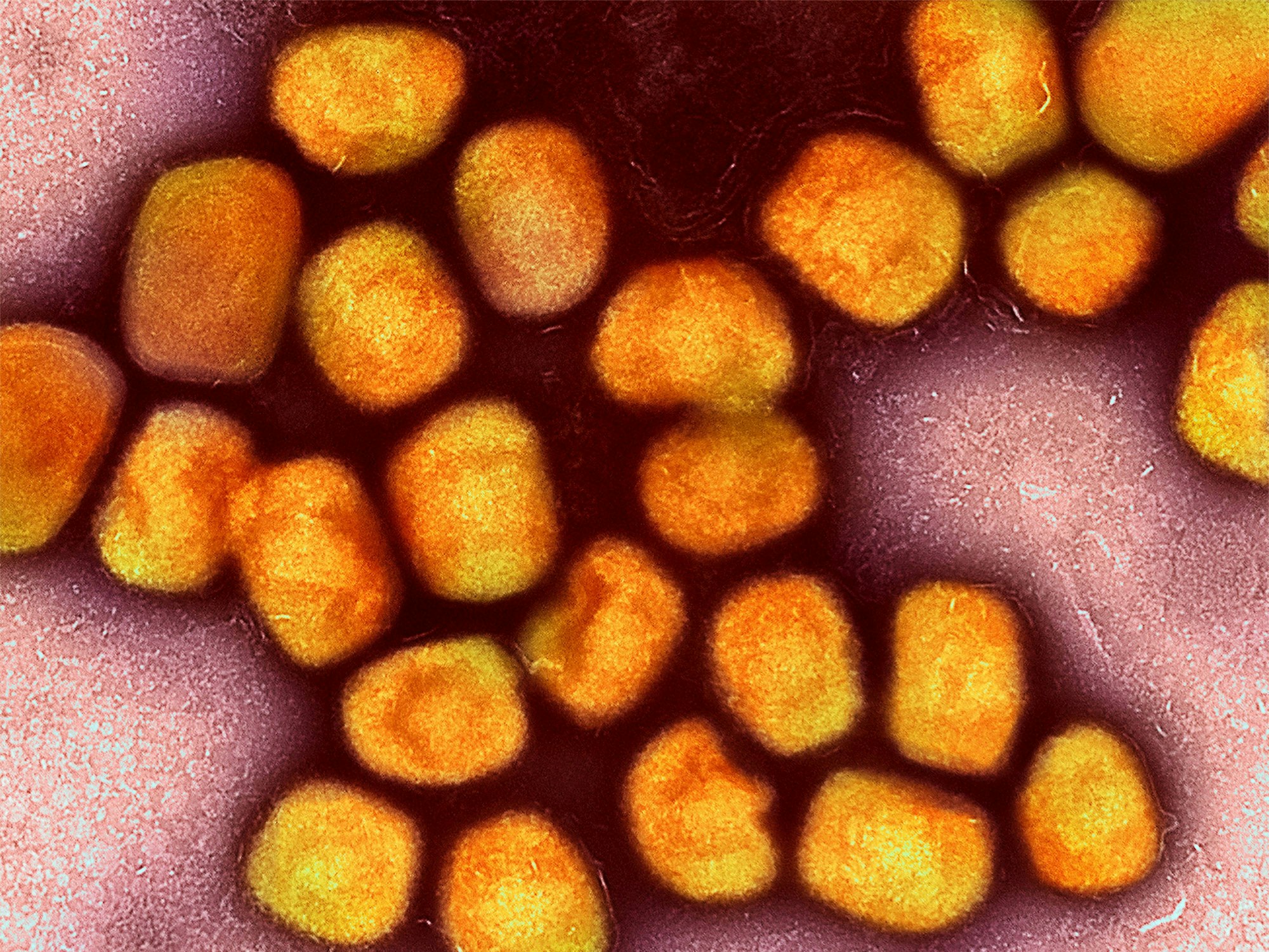 Eine kolorierte transmissionselektronenmikroskopische Aufnahme von Partikeln des Affenpockenvirus (Gold), kultiviert und gereinigt aus einer Zellkultur, aufgenommen in der NIAID Integrated Research Facility, veröffentlicht am 26. Juli 2022.