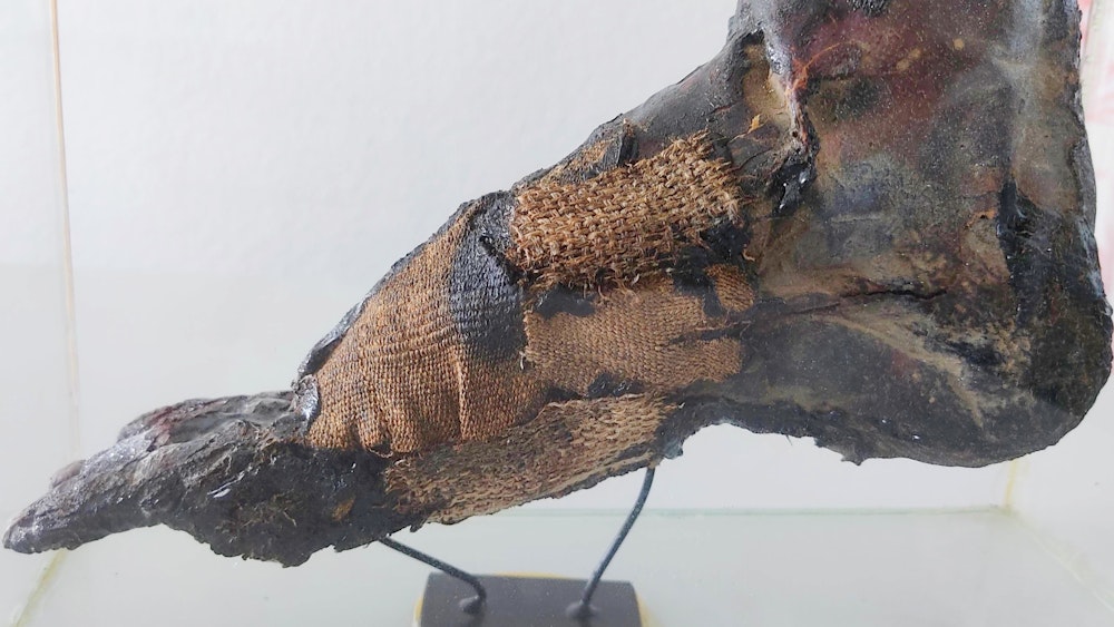 Das Foto zeigt den Mumienfuß, der bei eBay-Kleinanzeigen verkauft werden sollte.