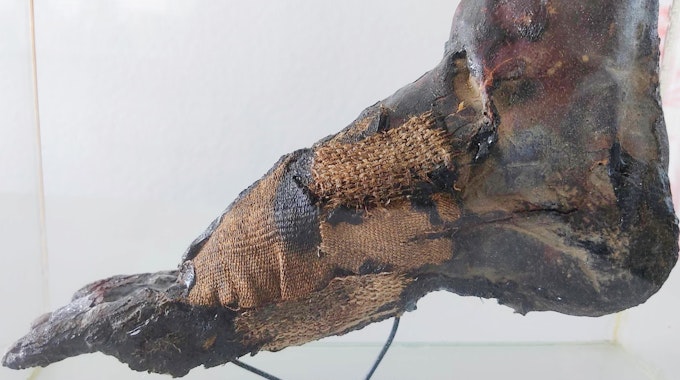 Das Foto zeigt den Mumienfuß, der bei eBay-Kleinanzeigen verkauft werden sollte.