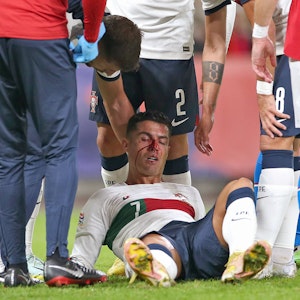 Cristiano Ronaldo Portugal verletzt nach Zusammenprall und muss behandelt werden.