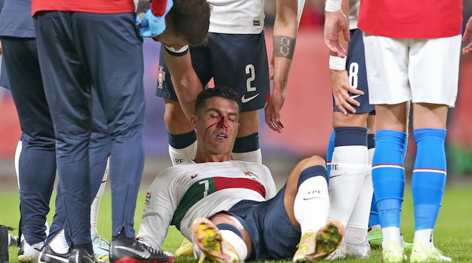 Cristiano Ronaldo Portugal verletzt nach Zusammenprall und muss behandelt werden.