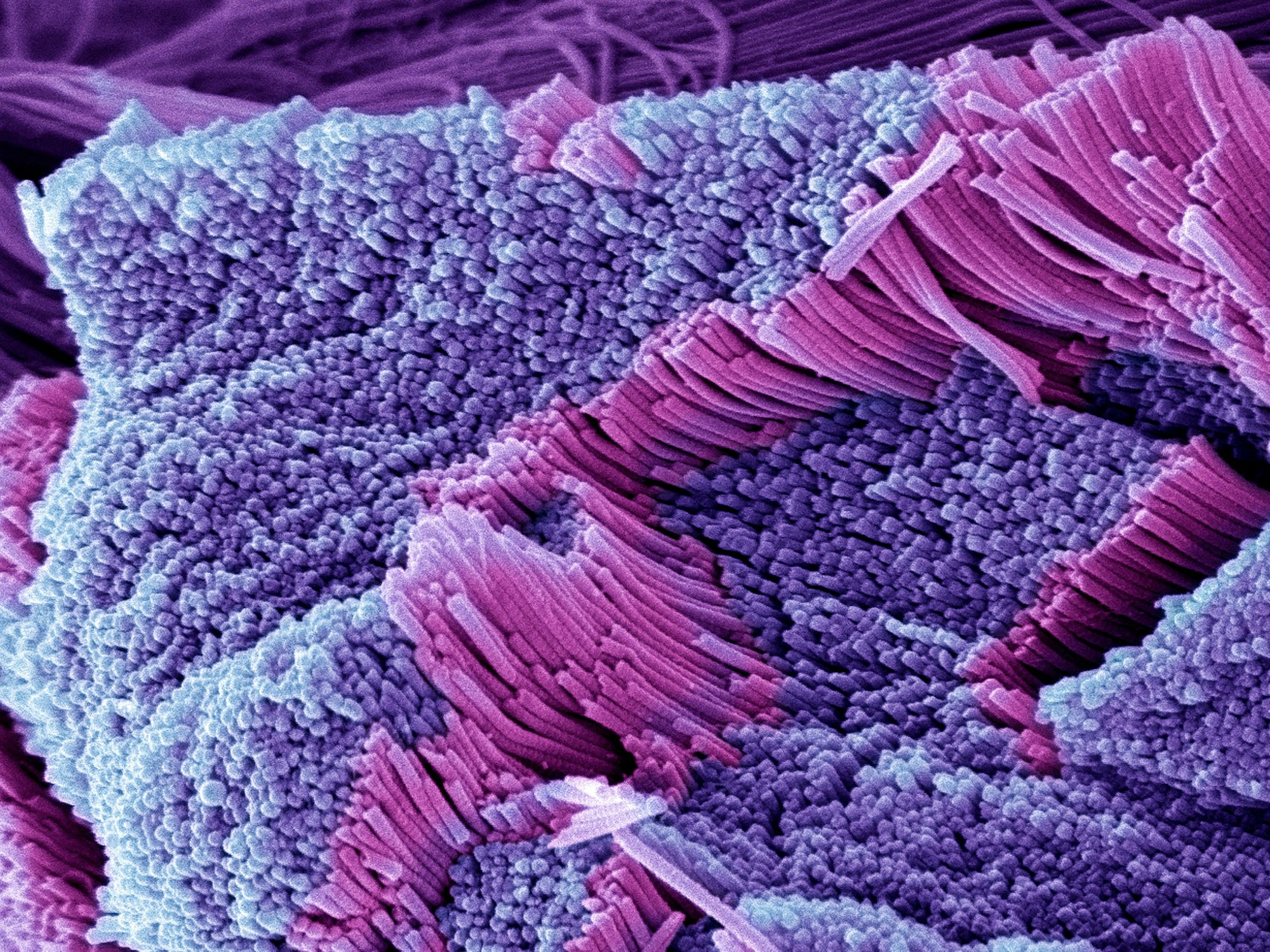 Kollagenfasern des menschlichen Körpers unterm Elektronenmikroskop