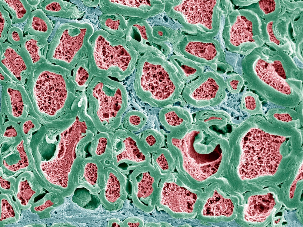 Nervenfasern des menschlichen Körpers unterm Elektronenmikroskop