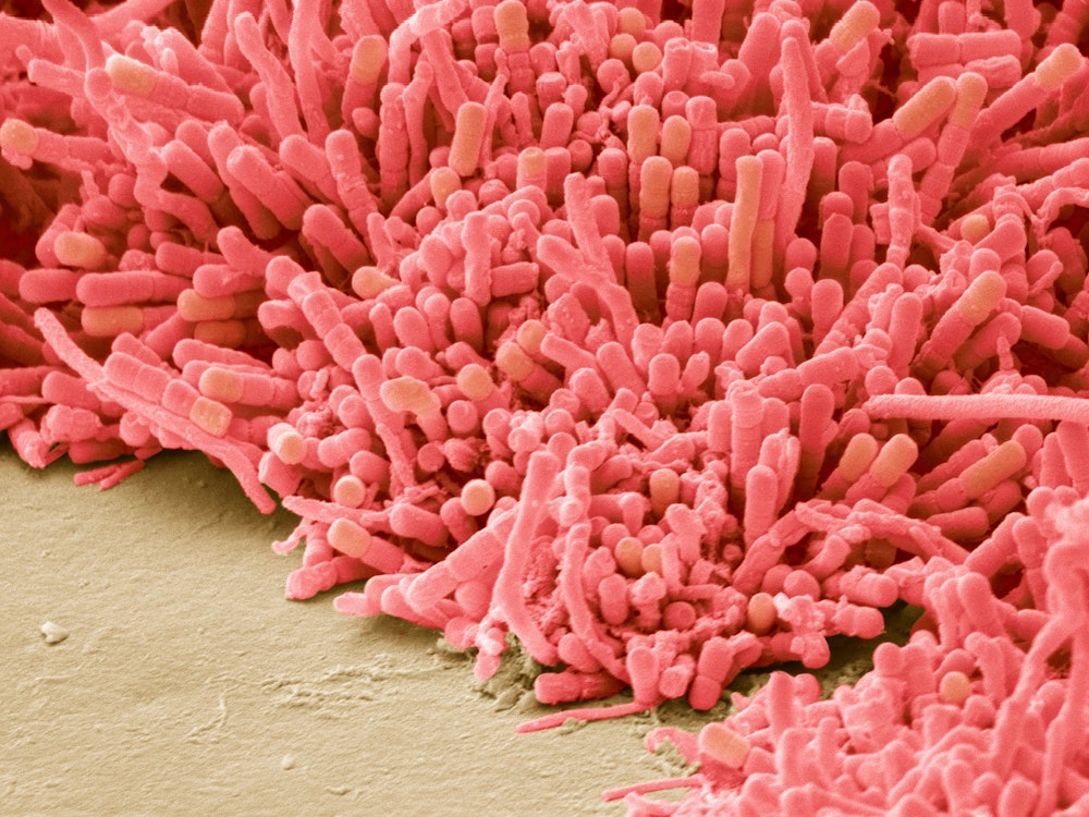 Bakterien auf den menschlichen Zähnen, Aufnahme eines Elektronenmikroskopes