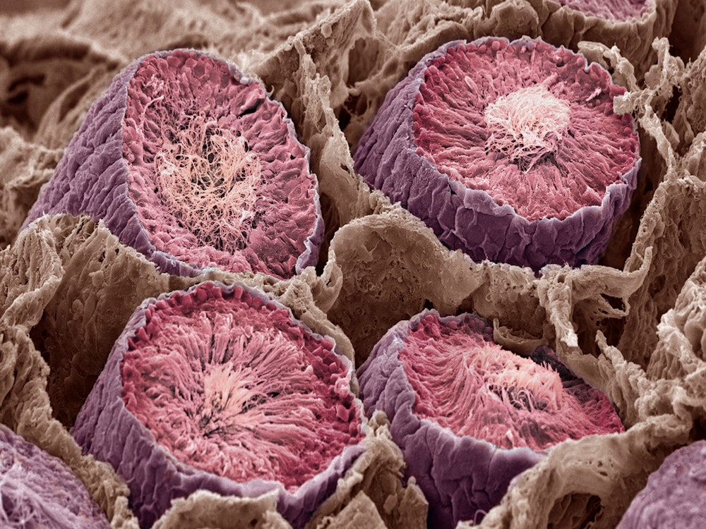 Samenkanälchen unter dem Elektronenmikroskop betrachtet
