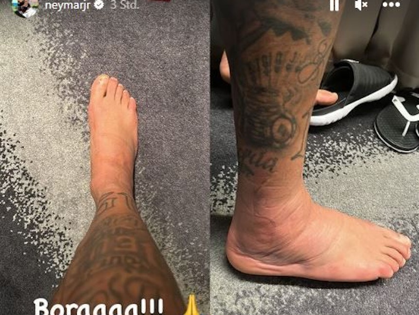 Neymar zeigt seinen geschwollenen Fuß auf Instagram.