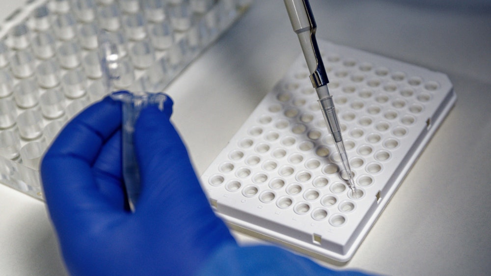 Eine Mitarbeiterin des Labors CBT füllt mit einer Pipette zur Vorbereitung von Corona PCR-Tests eine Testflüssigkeit in einer Trägerplatte.