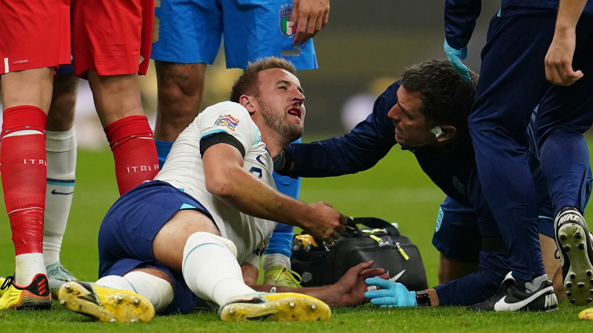 Der englische Nationalspieler Harry Kane wird nach einem Zusammenprall am Kopf behandelt.