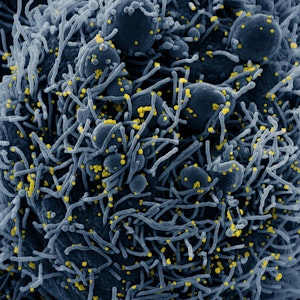 Auf dieser vom US-Forschungszentrum «National Institute of Allergy and Infectious Diseases» (NIAID) zur Verfügung gestellten Aufnahme ist eine Zelle (blau) mit dem Coronavirus infiziert. (Symbolbild)