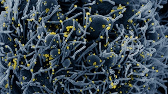 Auf dieser vom US-Forschungszentrum «National Institute of Allergy and Infectious Diseases» (NIAID) zur Verfügung gestellten Aufnahme ist eine Zelle (blau) mit dem Coronavirus infiziert. (Symbolbild)