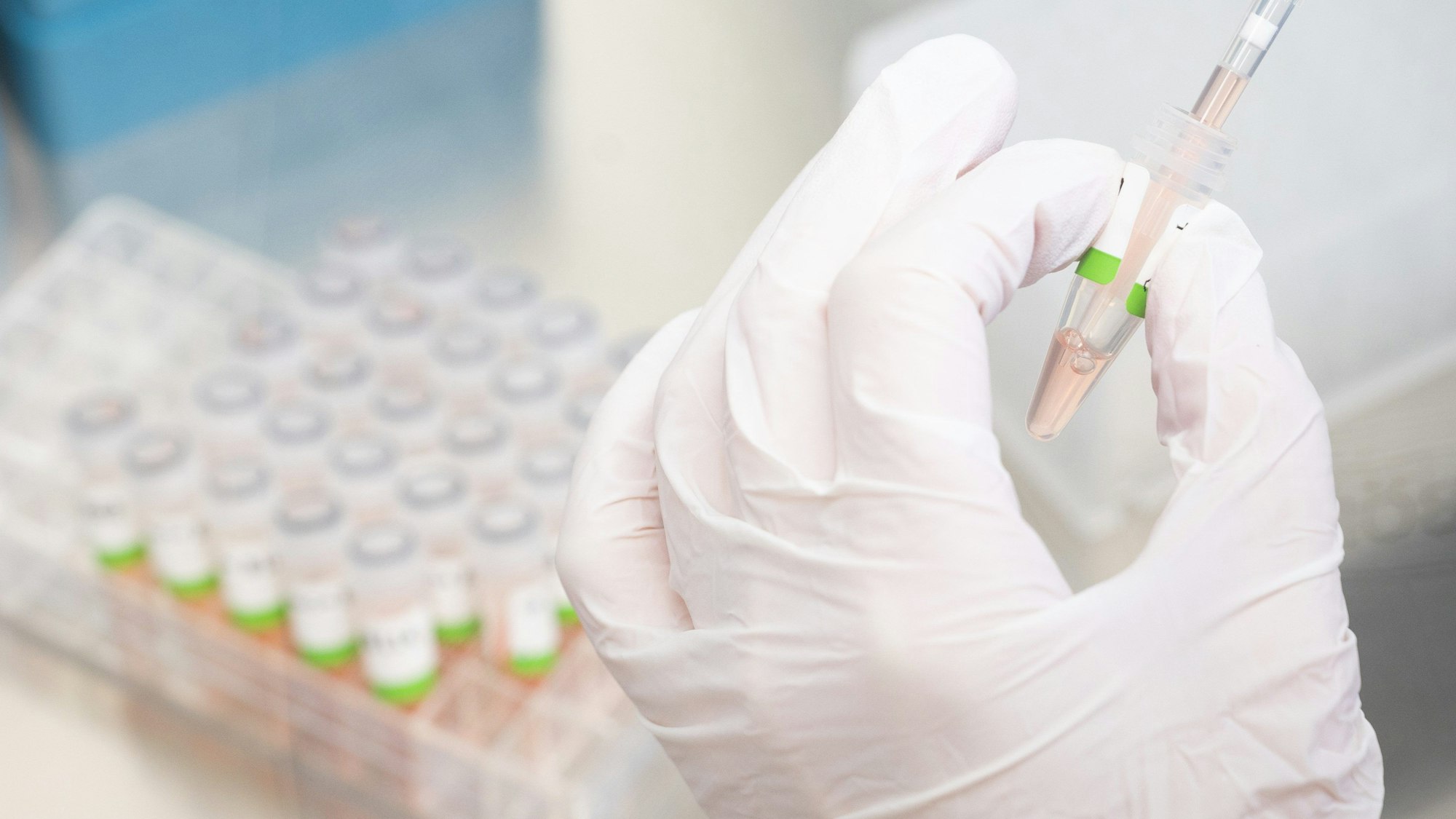 Eine Medizinerin bereitet PCR-Tests gegen das Coronavirus vor. Man sieht nur die Hände und Test-Proben.
