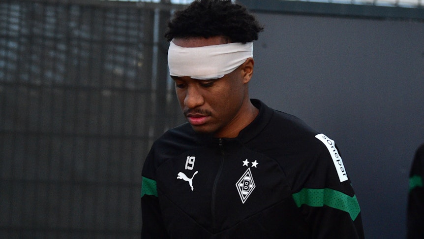 Borussia Mönchengladbach's Nathan N'Goumou had to train with a clearly visible bandage on Monday (January 9, 2023) because of hailstone in his eye.