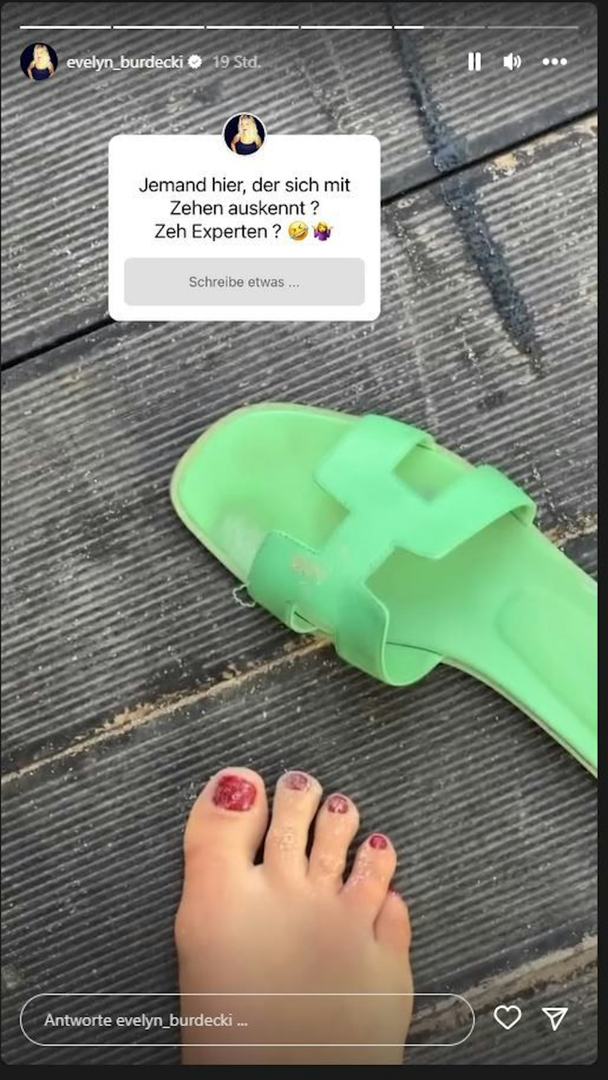 Evelyn Burdecki zeigt in einer Instagram-Story vom 9.1.2023 ihren rechten Fuß. Der kleine Zeh ist nach ihren Angaben gebrochen.