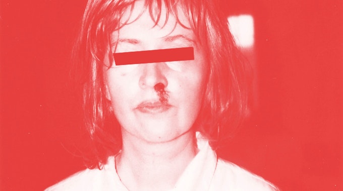 Die Künstlerin Rosemarie Trockel hat sich selbst mit blutiger Nase und schwarzem Balken vor den Augen fotografiert.