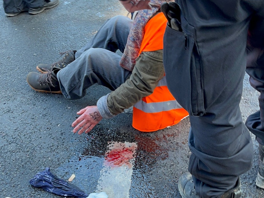 Eine Demonstrantin wird von der Straße gelöst, ihre Hand blutet.