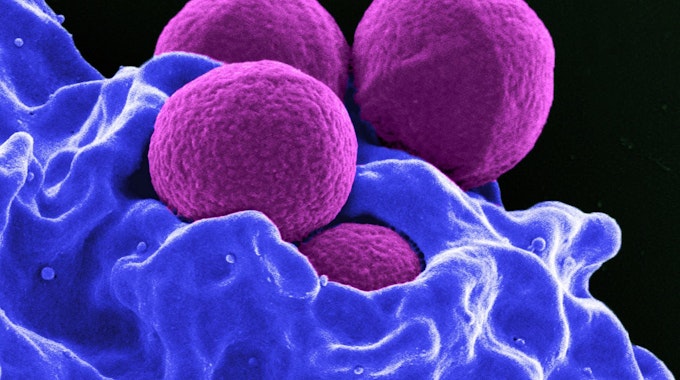 Produziert vom National Institute of Allergy and Infectious Diseases (NIAID), zeigt diese digital gefärbte Rasterelektronenmikroskopie (REM) vier magentafarbene, kugelförmige Methicillin-resistente Staphylococcus aureus (MRSA) Bakterien, die von blau gefärbten weißen Blutkörperchen (WBCs) phagozysiert werden.&nbsp;