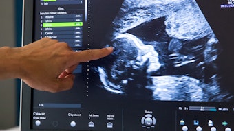 Ein Arzt zeigt auf einem Ultraschall-Bild auf den Kopf eines Babys.