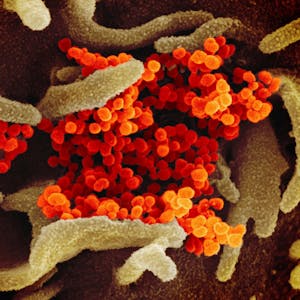 Eine undatierte elektronenmikroskopische Aufnahme des U.S. National Institute of Health zeigt das neuartige Coronavirus (SARS-CoV-2). (Archivbild)