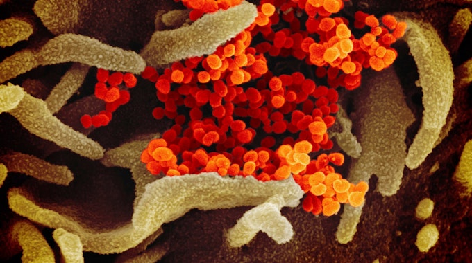 Eine undatierte elektronenmikroskopische Aufnahme des U.S. National Institute of Health zeigt das neuartige Coronavirus (SARS-CoV-2). (Archivbild)