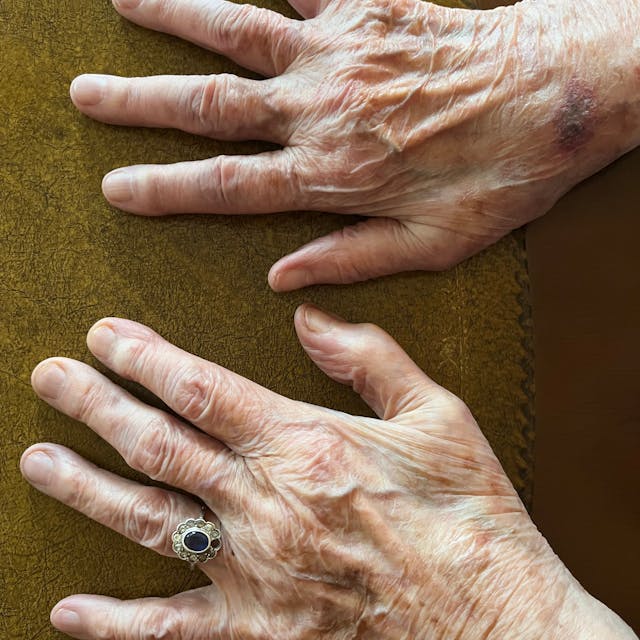 Detailaufnahme der Hand von Anna Nussbächer (97), die den Holocaust überlebt hat. Der Ring stammt von ihrer Mutter.&nbsp;