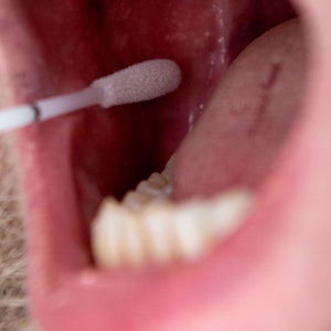 Das Symbolfoto aus dem Jahr 2019 zeigt einen Mann mit geöffnetem Mund und ein DNA-Teststäbchen, das Speichel an der Innenseite der Wange aufnimmt.