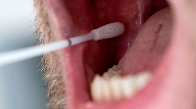 Das Symbolfoto aus dem Jahr 2019 zeigt einen Mann mit geöffnetem Mund und ein DNA-Teststäbchen, das Speichel an der Innenseite der Wange aufnimmt.