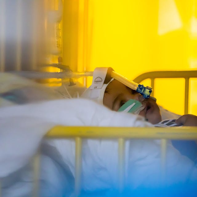 Ein Kind liegt in einem Krankenhausbett mit Schlauch im Gesicht.