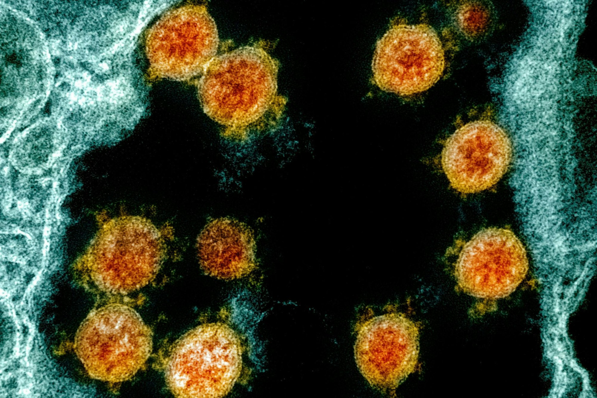 Partikel des Coronavirus SARS-CoV-2 wurden für eine elektronenmikroskopische Aufnahme am „National Institute of Allergy and Infectious Diseases Integrated Research Facility“ farblich bearbeitet.