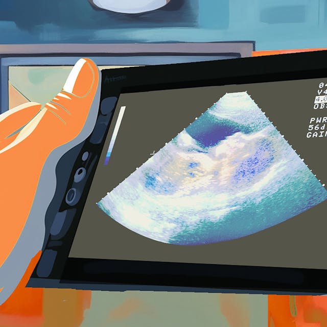 Garfik von zwei Hände, die einen Bildschirm mit Utltraschallaufnahme eines Embryos halten.