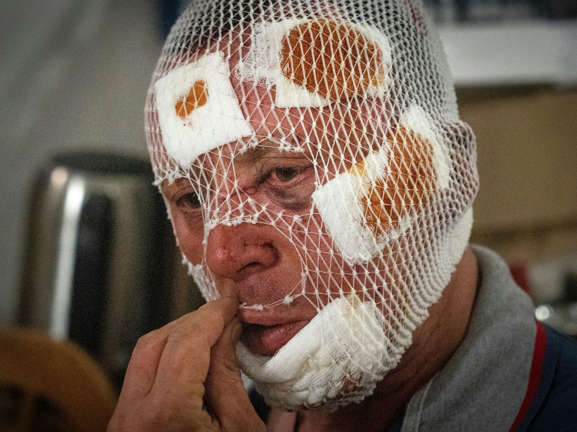 Ein verwundeter ukrainischer Soldat fasst sich am 24. Mai 2023 an einem medizinischen Stabilisierungspunkt in der Nähe von Bachmut (Ukraine) an den Mund.