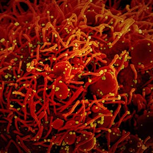 Eine Aufnahme des Coronavirus unter einem Mikroskop, bereitgestellt vom US-Forschungszentrum „National Institute of Allergy and Infectious Diseases“ (NIAID).