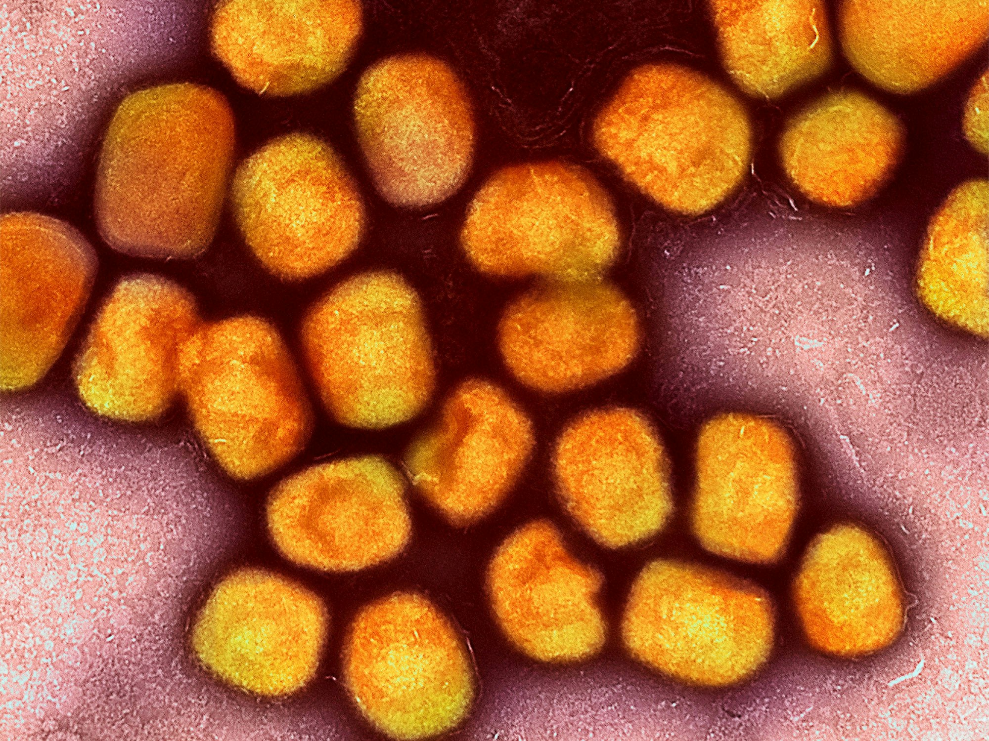 Das Foto zeigt eine kolorierte transmissionselektronenmikroskopische Aufnahme von Partikeln des Affenpockenvirus (Gold).